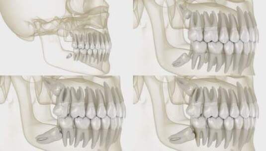 智齿内侧嵌塞到第二磨牙。医学上精确的牙齿高清在线视频素材下载