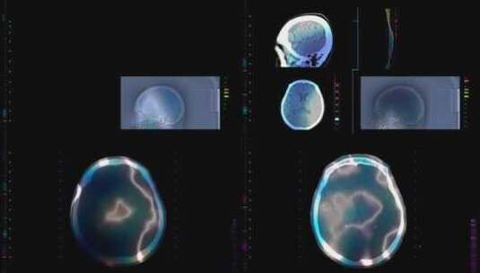 核磁共振脑技术数据数字板高清在线视频素材下载