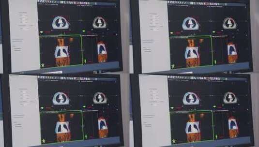 医生操作电脑屏幕放疗高清在线视频素材下载