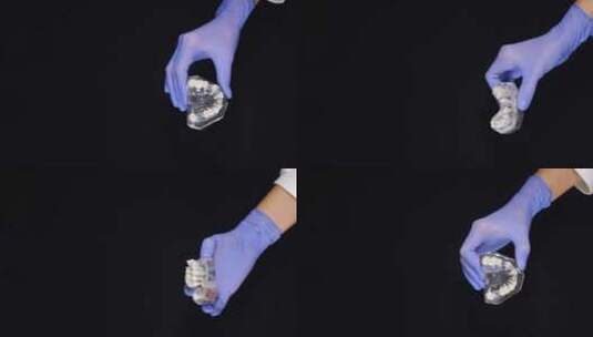 蓝色手套中的女性手握住下巴模型，带有牙科桥接和牙冠样本高清在线视频素材下载