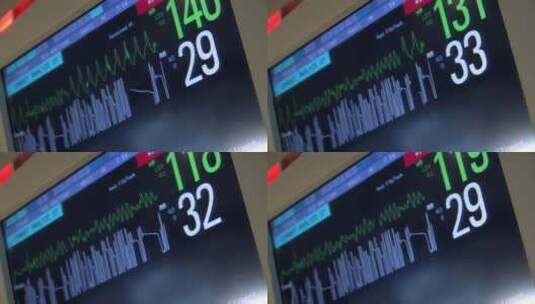医疗心电图跳动3d动画高清在线视频素材下载
