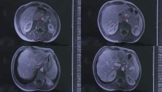 医院CT胸片高清在线视频素材下载