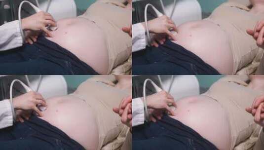 接受超声波扫描的孕妇高清在线视频素材下载