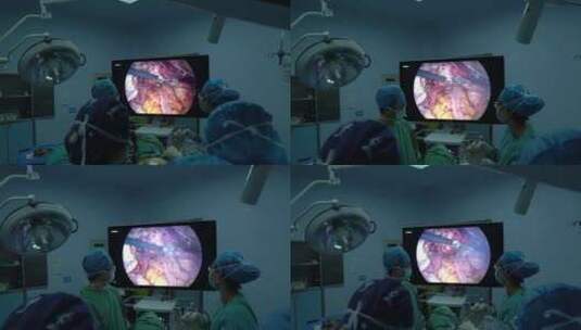 妇科手术（子宫切除）高清在线视频素材下载