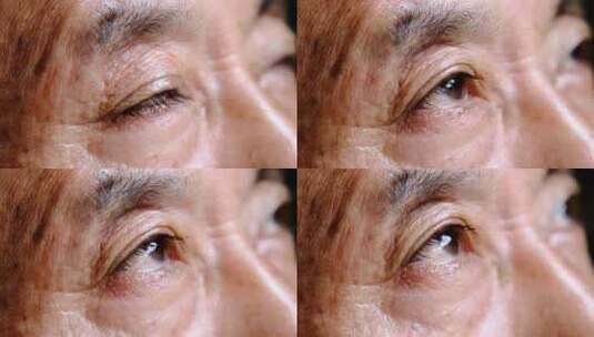 老人眼睛睁开   眼神变化高清在线视频素材下载