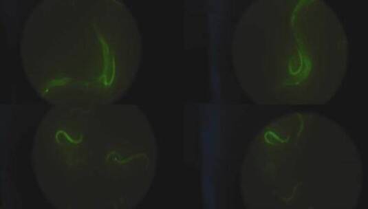 在显微镜下放大的绿色微生物高清在线视频素材下载