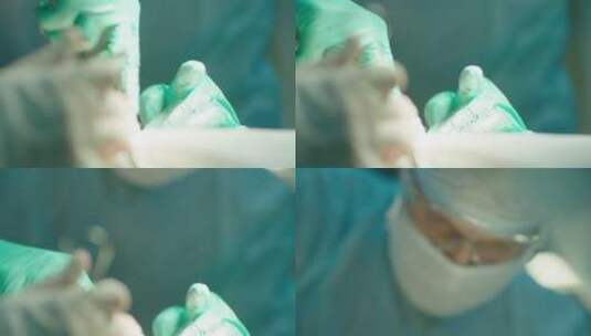 外科医生团队在手术室做手术高清在线视频素材下载