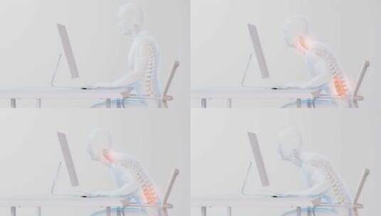 颈椎脊椎腰椎间盘医疗人体骨骼办公久坐高清在线视频素材下载