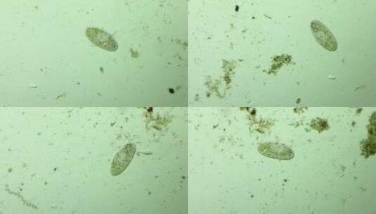 显微镜下的微观世界，草履虫5高清在线视频素材下载