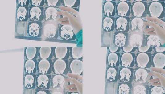 医生正在研究脑部CT高清在线视频素材下载