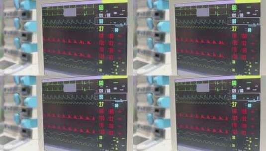 心电图监护仪正在工作高清在线视频素材下载