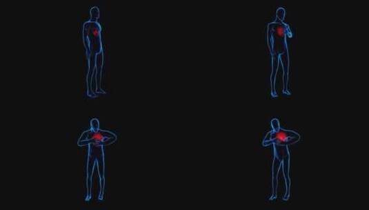 心脏病发作症状心力衰竭心血管疾病血液循环高清在线视频素材下载