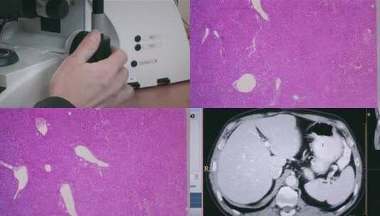 显微镜微生物高清在线视频素材下载