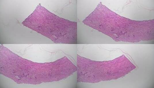 在显微镜40x下观察人体动脉切片以检查组高清在线视频素材下载