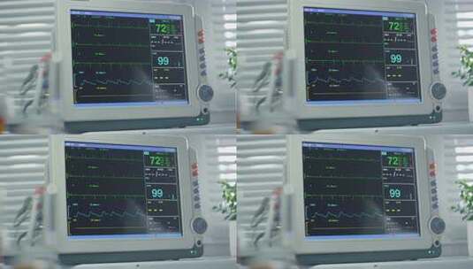 心电图医院重症监视器高清在线视频素材下载