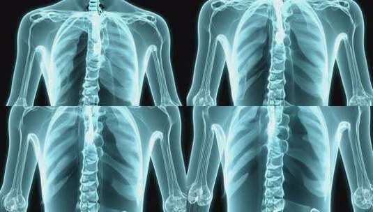 人体骨骼X光透视效果影像高清在线视频素材下载