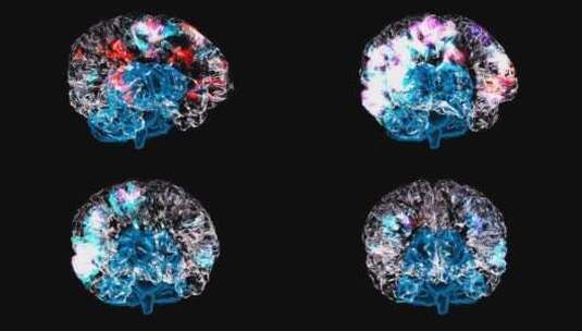 水晶玻璃大脑神经元高清在线视频素材下载