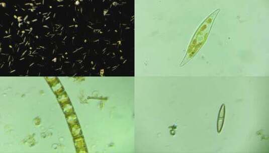 显微镜下的微生物硅藻合集高清在线视频素材下载