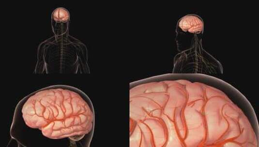 脑卒中大脑血管堵塞动画高清在线视频素材下载