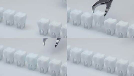 牙医牙科模型高清在线视频素材下载