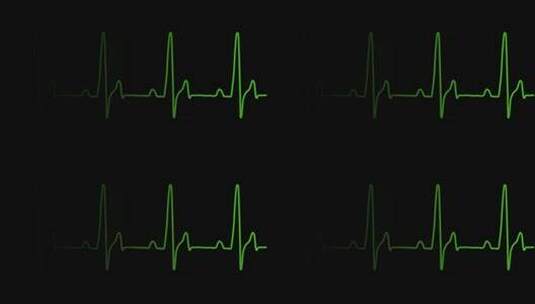 心率心电图跳动高清在线视频素材下载
