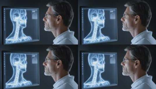 医生观察头部X光影像的医疗场景高清在线视频素材下载