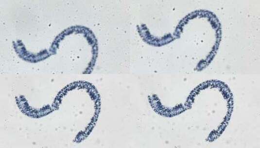 微生物显微镜观察水螅横切面高清在线视频素材下载