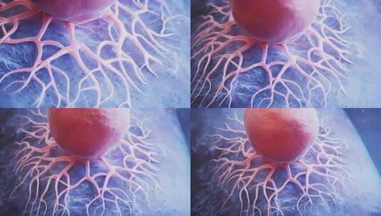 生物癌细胞与疾病高清在线视频素材下载