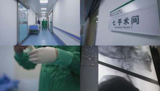 介入科反射做造影手术造影血管穿刺手术合集高清在线视频素材下载