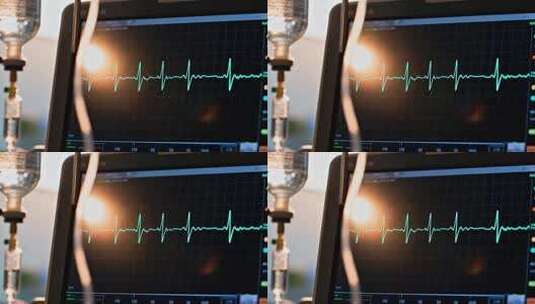 医院输液监测心电图画面高清在线视频素材下载