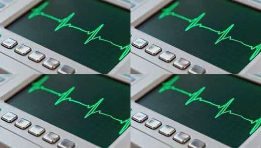 心电图监测设备画面高清在线视频素材下载