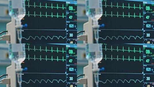 医院心电图监测设备画面高清在线视频素材下载