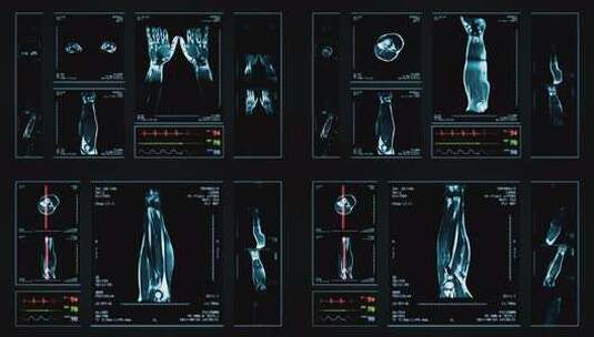 循环手臂核磁共振扫描。蓝色。1个文件中的高清在线视频素材下载