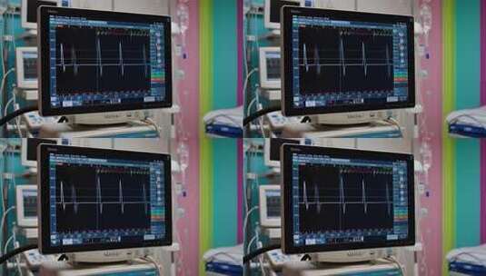 医院心电图监测设备画面高清在线视频素材下载