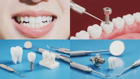 种植牙片头牙科诊所牙齿护理牙齿美白高清在线视频素材下载