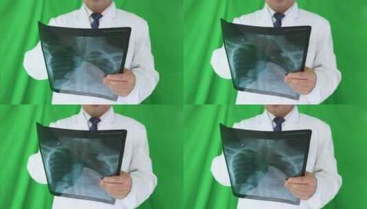 外科医生看胸片高清在线视频素材下载