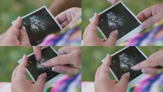 妇女手里拿婴儿的超声波图像高清在线视频素材下载