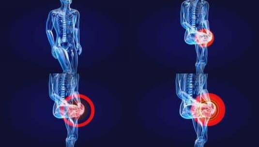 受伤膝盖的解剖照片高清在线视频素材下载
