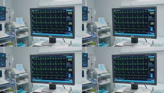 医院心电监护仪屏幕画面高清在线视频素材下载