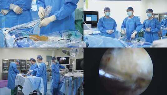 4K医院膝关节微创手术高清在线视频素材下载