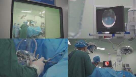 手术室医生给患者做手术高清在线视频素材下载