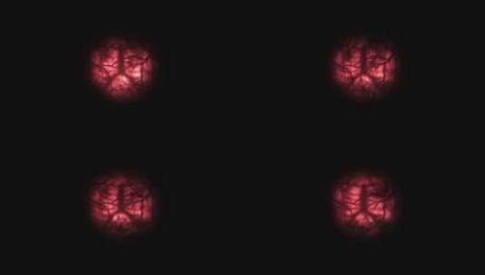 4k树状的血管红色球眼球 (1)高清在线视频素材下载