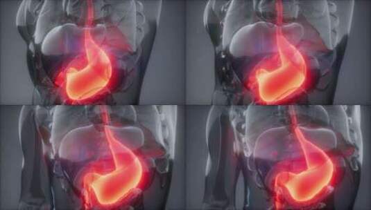 人体胃放射学检查高清在线视频素材下载