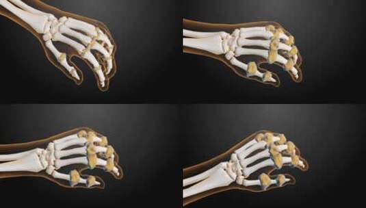 关节炎手的3d渲染插图高清在线视频素材下载