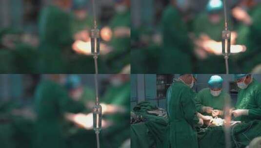 骨科膝关节重置手术高清在线视频素材下载