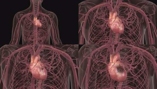 人体心脏3D跳动动画心脏病变坏死透明通道高清在线视频素材下载