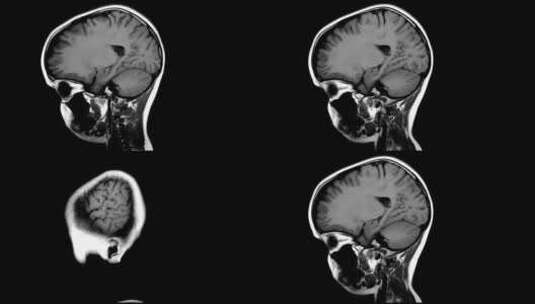 医学 大脑 脑科学 三维 脑ct1 模型高清在线视频素材下载