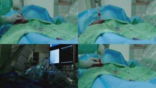 医生手术抽取血液样本高清在线视频素材下载