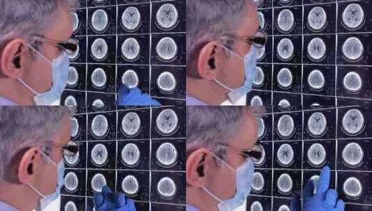 神经科医生看核磁共振高清在线视频素材下载