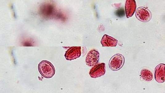 微生物显微镜观察绦虫卵高清在线视频素材下载